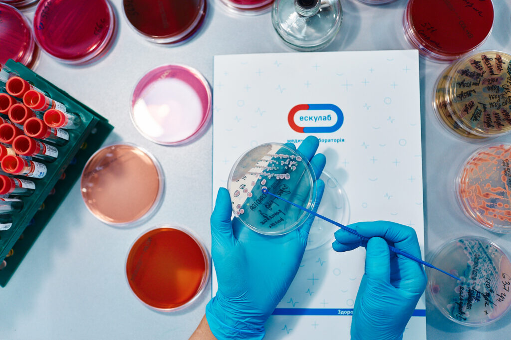 інтерв’ю Ескулаб вебпромо